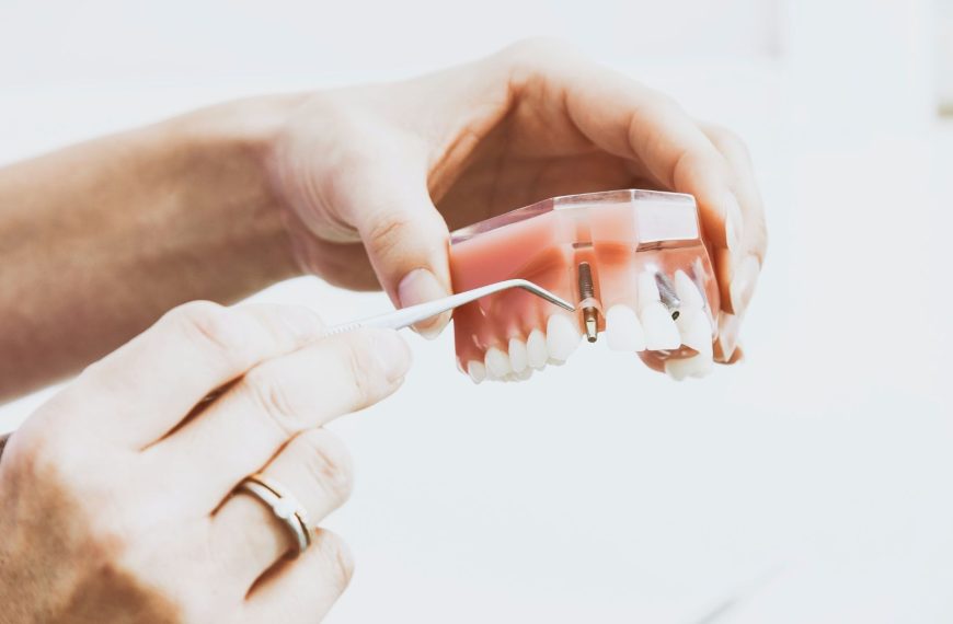 Implantologia – rewolucja w stomatologii estetycznej